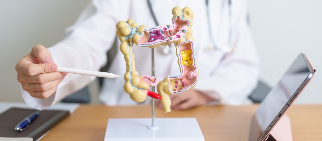 doctor with human colon anatomy model and tablet. colonic disease, large intestine, colorectal cancer, ulcerative colitis, diverticulitis, irritable bowel syndrome and digestive system