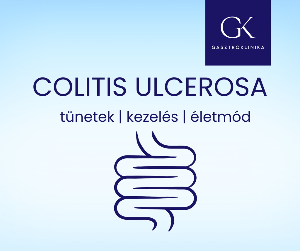 colitis ulcerosa kezelése, tünetei és életmód