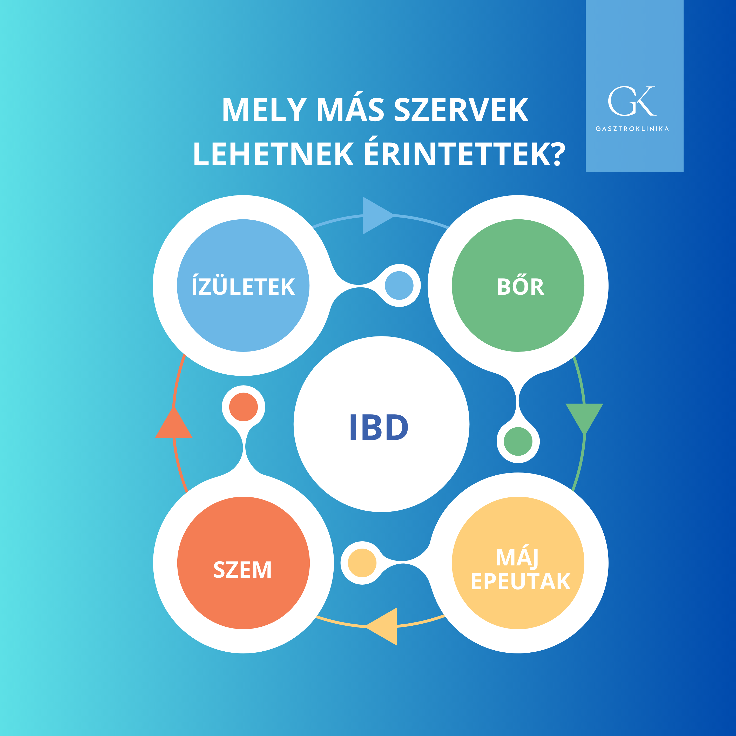 „Illusztráció a gyulladásos bélbetegségek (IBD) extraintesztinális tüneteiről,