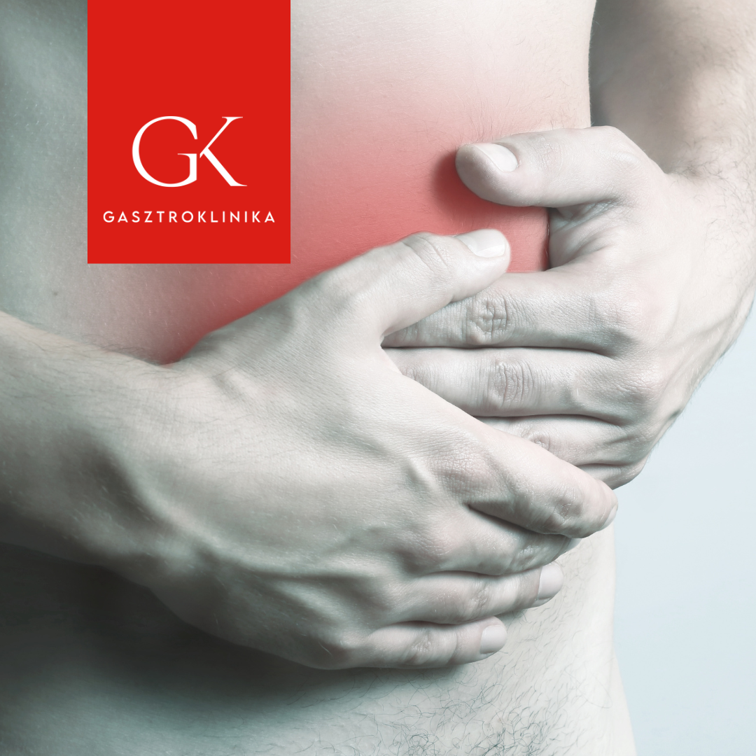 Diverticulosis és diverticulitis: tünetek, kezelés, étrend