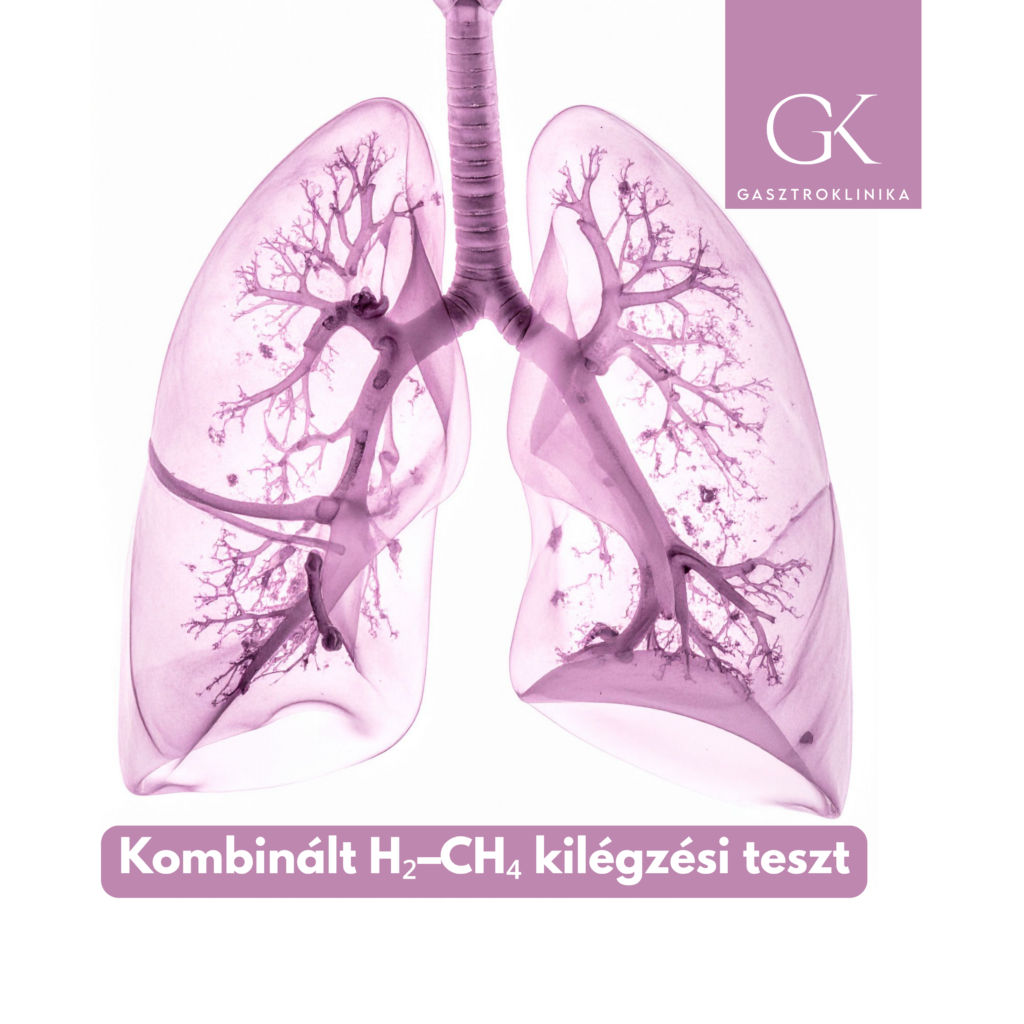 kombinált h₂–ch₄ kilégzési teszt miért pontosabb, és mikor érdemes elvégezni
