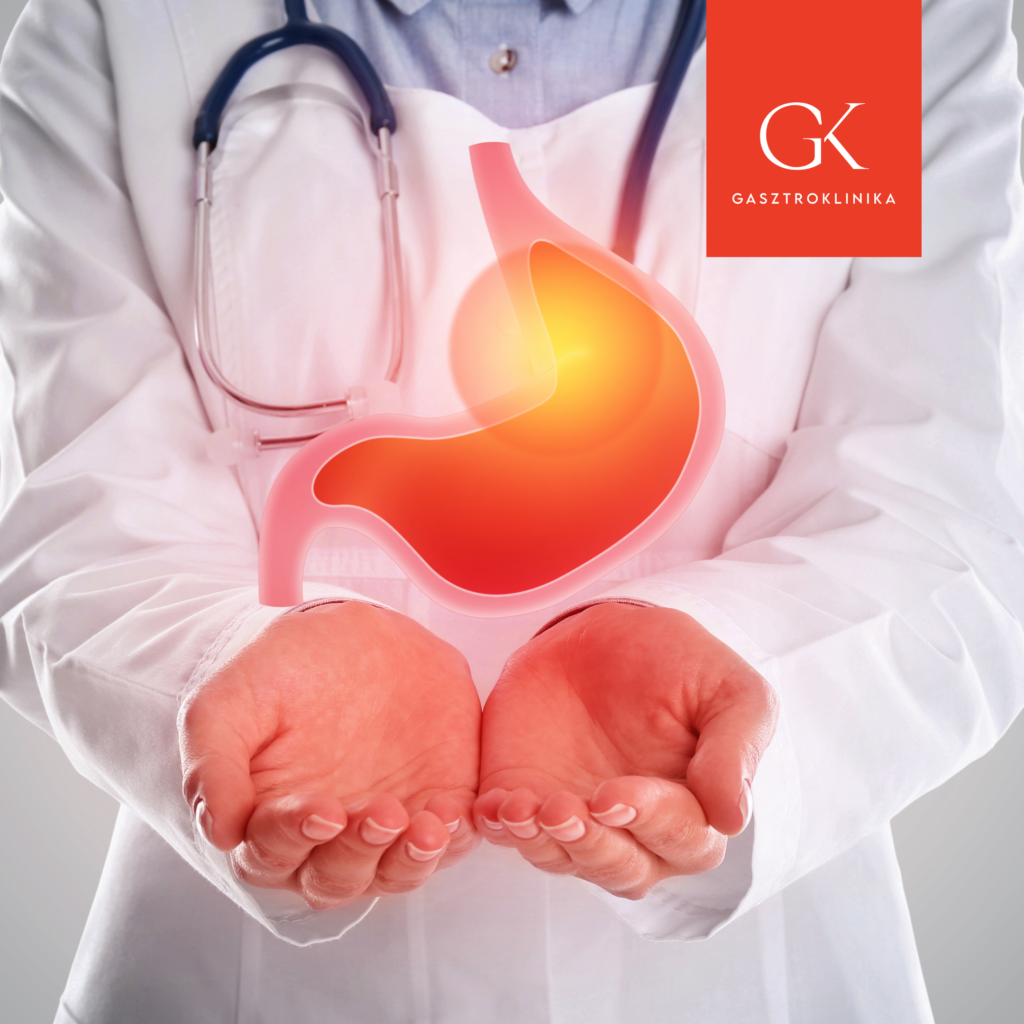 tartos gyomoreges kivizsgalasa reflux