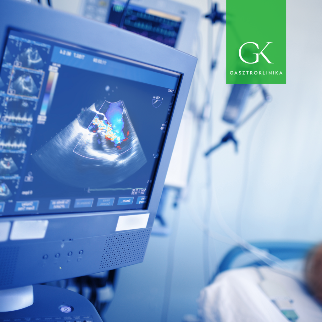 hasi ultrahang képe emésztőrendszeri panaszok kivizsgálásakor